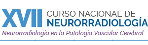 2021 CURSO NEURORRADIOLOGIA - No socio